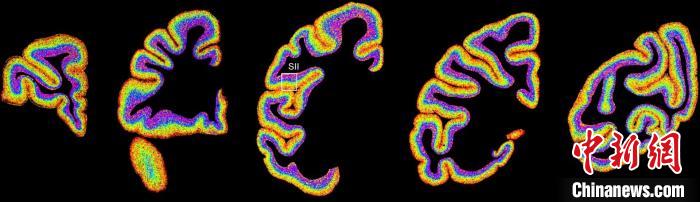 アカゲザルの脳における異なる種類の細(xì)胞の分布狀況。畫像提供は中國科學(xué)院脳科學(xué)?スマート技術(shù)卓越イノベーションセンター